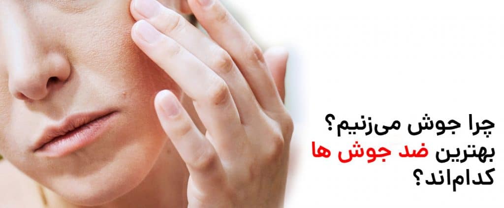 جلوگیری و درمان جوش و آکنه