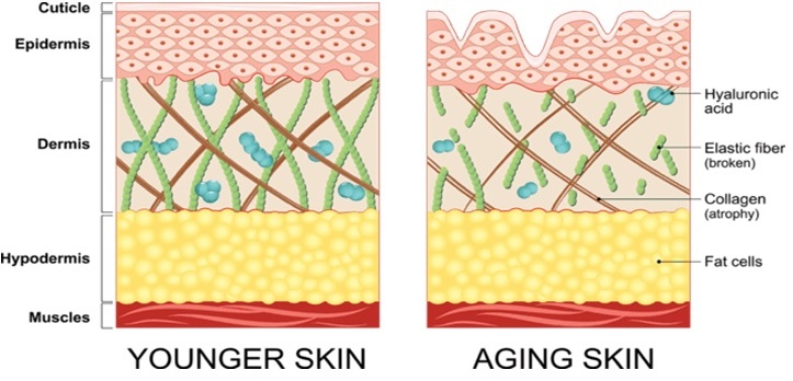 کاهش کلاژن در پوست