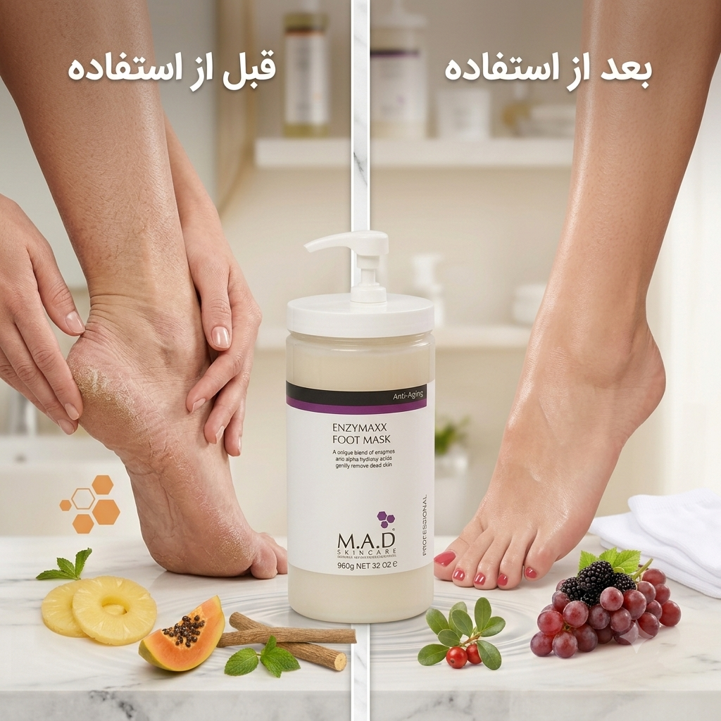 قبل و بعد از استفاده از ماسک آنزیمی پا ام ای دی – M.A.D