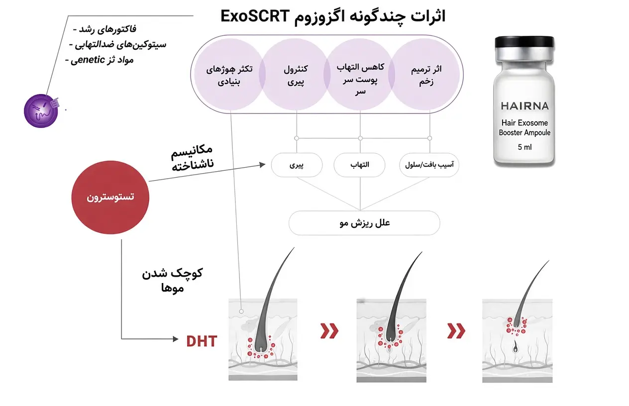 اگزوزوم موی هیرنا
