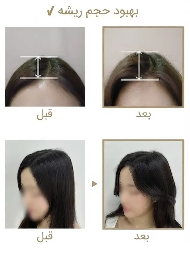 قبل و بعد استفاده از شامپو حجم دهنده گلدن بیوتین روتونیکس
