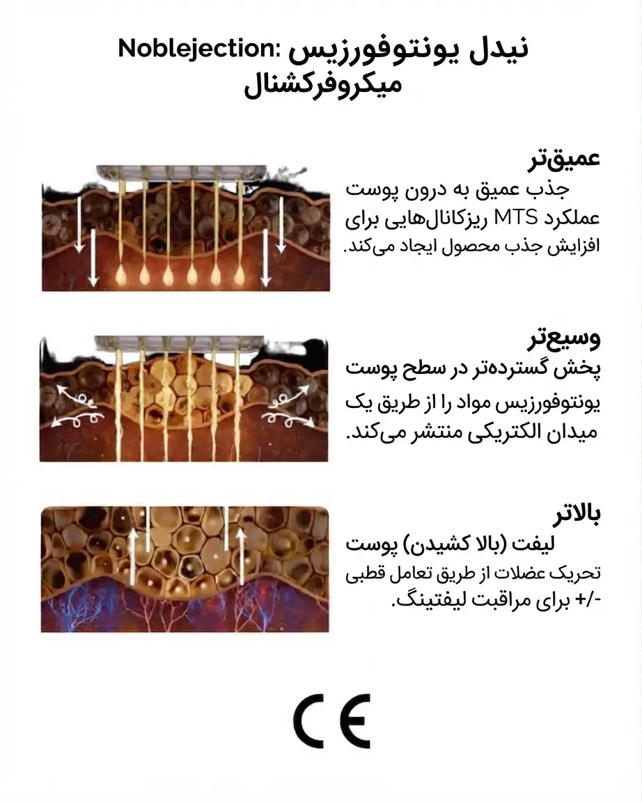 دستگاه میکروفرکشنال نوبلجکشن (Noblejection)