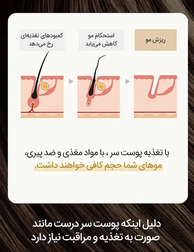 نحوه عملکرد شامپو حجم دهنده گلدن بیوتین روتونیکس