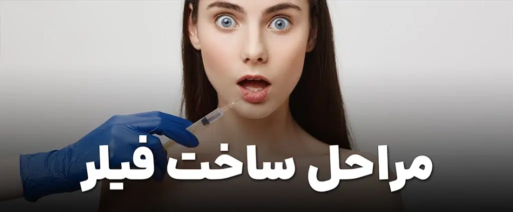 فیلر و مراحل ساخت آن